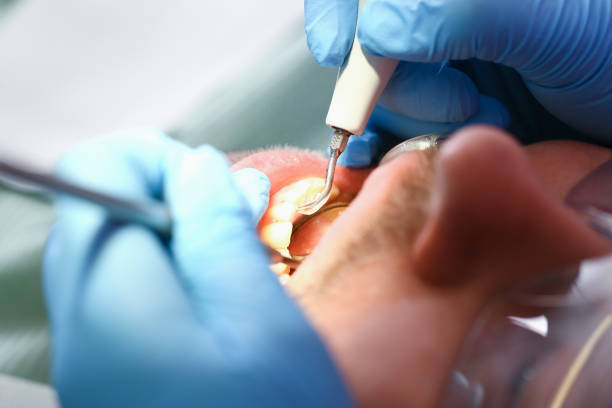 Best Emergency Dental Services for Seniors in Orinda, CA